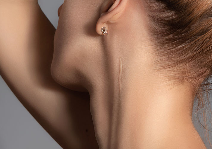 Woman showing her neck scar